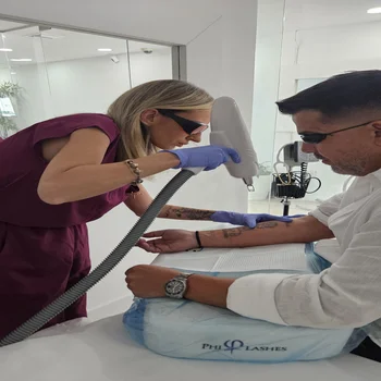 Laser Tattoo Removal Hialeah 